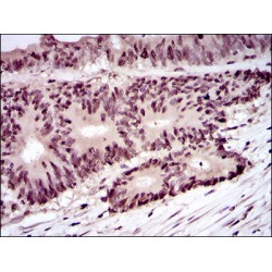 Proliferating Cell Nuclear Antigen (PCNA) Antibody