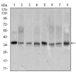 Proliferating Cell Nuclear Antigen (PCNA) Antibody