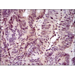 Proliferating Cell Nuclear Antigen (PCNA) Antibody