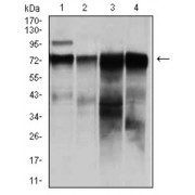 Western blot analysis using RAF1 antibody against human RAF1 (AA: 198-407) recombinant protein. (Expected MW is 48.6 kDa).