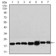 Western blot analysis using RPL18A antibody against human RPL18A recombinant protein. (Expected MW is *** kDa).