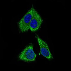 Ribosomal Protein L18A (RPL18A) Antibody