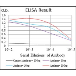 Ribosomal Protein S6 Kinase Beta 1 (RPS6KB1) Antibody
