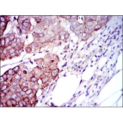 Ribosomal Protein S6 Kinase Beta 1 (RPS6KB1) Antibody