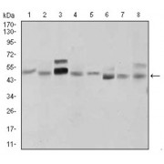 Western blot analysis using SHH antibody against human SHH recombinant protein. (Expected MW is 41 kDa).