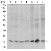 Western blot analysis using SKP1 antibody against human SKP1 (AA: 1-160) recombinant protein. (Expected MW is 50 kDa).