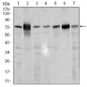 Western blot analysis using SLC27A5 antibody against human SLC27A5 recombinant protein. (Expected MW is 32.9 kDa).