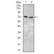 Western blot analysis using SLC27A5 antibody against human SLC27A5 recombinant protein. (Expected MW is 32.9 kDa).