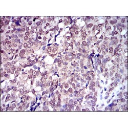 Glucose Transporter 4 / GLUT4 (SLC2A4) Antibody