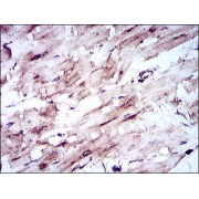 Western blot analysis using SLC2A4 antibody against human SLC2A4 recombinant protein. (Expected MW is 39.9 kDa).