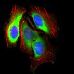 Glucose Transporter 4 / GLUT4 (SLC2A4) Antibody