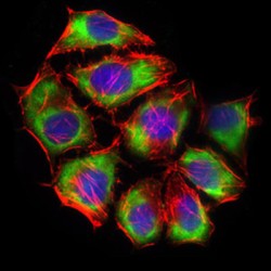 Glucose Transporter 4 / GLUT4 (SLC2A4) Antibody