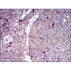 Glucose Transporter 4 / GLUT4 (SLC2A4) Antibody