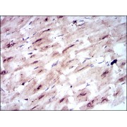 Western blot analysis using SLC2A4 antibody against human SLC2A4 recombinant protein. (Expected MW is 39.9 kDa).