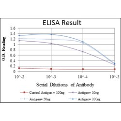 Mothers Against Decapentaplegic Homolog 2 (SMAD2) Antibody