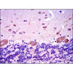 Mothers Against Decapentaplegic Homolog 2 (SMAD2) Antibody
