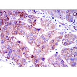 Mothers Against Decapentaplegic Homolog 2 (SMAD2) Antibody