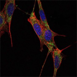 Mothers Against Decapentaplegic Homolog 4 (SMAD4) Antibody