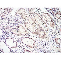 Mothers Against Decapentaplegic Homolog 4 (SMAD4) Antibody