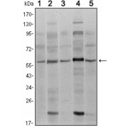 Western blot analysis using SMAD4 antibody against A431 (1), SK-N-SH (2), K562 (3), HepG2 (4) and HUVE12 (5) cell lysate.