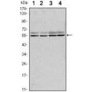 Western blot analysis using SMAD6 antibody against A431 (1), A431 (2), Hela (3) and Jurkat (4) cell lysate.
