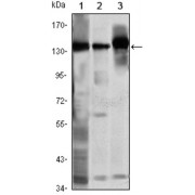 Western blot analysis using SMC1 antibody against K562 (1), Jurkat (2) and A549 (3) cell lysate.