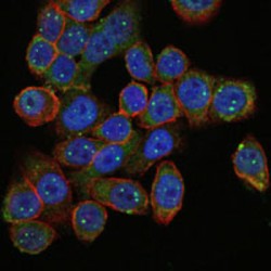 Survival of Motor Neuron 1, Telomeric (SMN1) Antibody