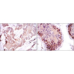 Survival of Motor Neuron 1, Telomeric (SMN1) Antibody