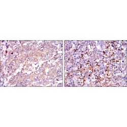 Survival of Motor Neuron 1, Telomeric (SMN1) Antibody