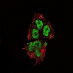 Transcription Factor SOX-2 (SOX2) Antibody