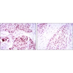 Transcription Factor SOX-2 (SOX2) Antibody