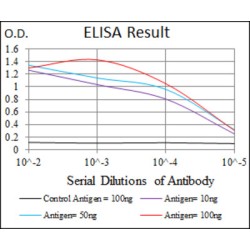 Sequestosome 1 (SQSTM1) Antibody