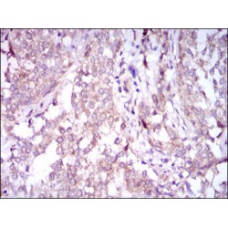 Sequestosome 1 (SQSTM1) Antibody