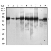 Western blot analysis using SQSTM1 antibody against human SQSTM1 recombinant protein. (Expected MW is 39.1 kDa).