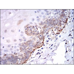 SRC Proto-Oncogene, Non-Receptor Tyrosine Kinase (SRC) Antibody