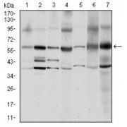 Western blot analysis using SRC antibody against human SRC (AA: 1-189) recombinant protein. (Expected MW is 47.8 kDa).