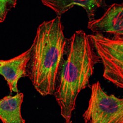 Signal Transducer And Activator of Transcription 3 (STAT3) Antibody