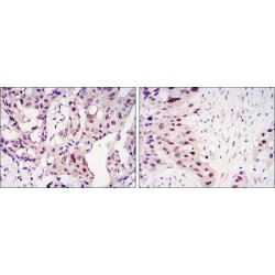 Signal Transducer And Activator of Transcription 3 (STAT3) Antibody