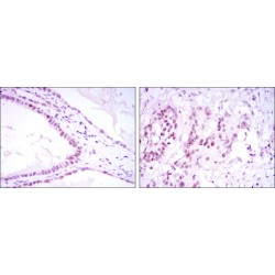 Polycomb Protein SUZ12 (SUZ12) Antibody