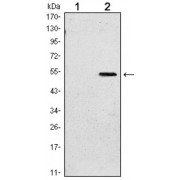 Western blot analysis using SUZ12 antibody against HEK293 (1) and SUZ12 (AA: 533-739) -hIgGFc transfected HEK293 (2) cell lysate.