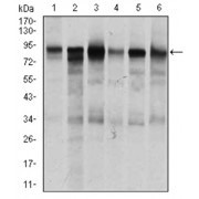 Western blot analysis using TGFBR3 antibody against human TGFBR3 recombinant protein. (Expected MW is 44.1 kDa).