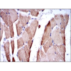 Troponin I, Fast Skeletal Muscle (TNNI2) Antibody