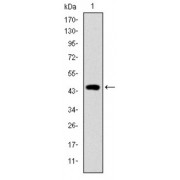 Western blot analysis using TNNI2 antibody against human TNNI2 (AA: 1-182) recombinant protein. (Expected MW is 46.8 kDa).