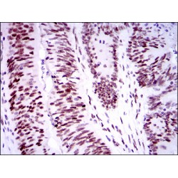 Tumor Protein P53 Binding Protein 1 (TP53BP1) Antibody