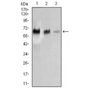 Western blot analysis using TRAFD1 antibody against human TRAFD1 recombinant protein. (Expected MW is 45 kDa).