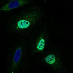 Wolf-Hirschhorn Syndrome Candidate 2 Protein (WHSC2) Antibody