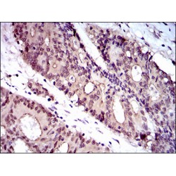 Wolf-Hirschhorn Syndrome Candidate 2 Protein (WHSC2) Antibody