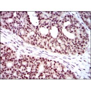 Western blot analysis using WHSC2 antibody against human WHSC2 recombinant protein. (Expected MW is 50.2 kDa).