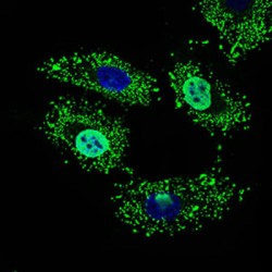 Wolf-Hirschhorn Syndrome Candidate 2 Protein (WHSC2) Antibody