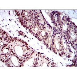 Wolf-Hirschhorn Syndrome Candidate 2 Protein (WHSC2) Antibody